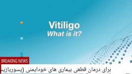 بیماری ویتیلیگو پیسی   برص چه درمانی داره؟
