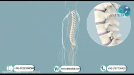 lumbar disk herniation in atrina