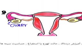 علائم کیست تخمدان رو ببینید برای درمان شروع کنید