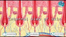 pilonidal sinus in atrina