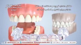 دندان قروچه حاملگی بهداشت دهان دندان