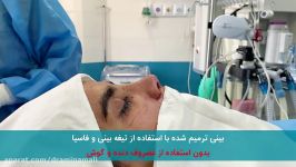 جراحی ترمیمی بینی دشوار بدون استفاد غضروف دنده گوش