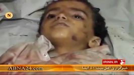 کشته زخمی شدن یمنی ها بر اثر حملات جنگنده های سعودی