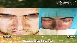 جراحی زیبایی بینی  جراح بینی تبریز