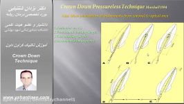 آموزش تکنیک کروان داون دکتر شنتیایی 