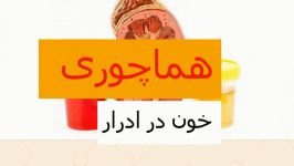 هماچوری یا خون در ادرار ـ دکتر میر صادقی