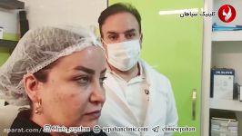 لیفت صورت  کلینیک زیبایی در اصفهان