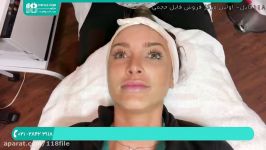 آموزش پاکسازی صورت  پاکسازی لایه برداری پوست درماپلنینگ 02128423118