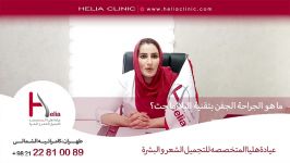 ما هو الجراحة الجفن بتقنية البلازما جت  عیادة هلیا  00989120234708