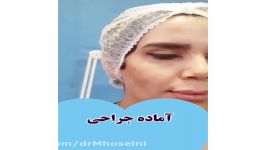 فیلم نتیجه سانترال لب 10 روز پس جراحی بلافاصله بعد کشیدن بخیه