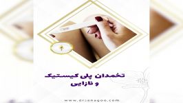 تخمدان پلی کیستیک نازایی