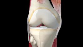 ACL Surgery  3D Reconstruction