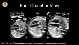 Advances in OBGYN Ultrasound Imaging 2018