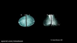 2018 Clinical Breast Imaging and Interventions Update