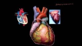 Heart Disease and Heart Attacks بیماری های قلبی حمله قلبی