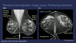 مجموعه فیلم آموزشی Breast Imaging 2020