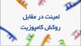 لمینت یا روکش کامپوزیت، مزایا معایب