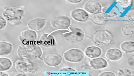نانوذرات طلا چگونه سلول سرطانی را منفجر می کند؟ شرکت نانو کاوشگران یکتای توس