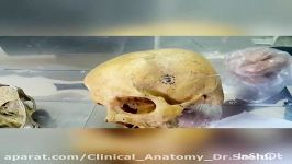 آناتومی عملی آناتومی عملی مبحث جمجمه قسمت بافت استخوانی سخت نمای طرفی