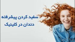 سفید کردن پیشرفته دندان یا بلیچینگ در کلینیک