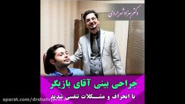 جراحی بینی آقای بازیگر انحراف مشکلات تنفسی شدید