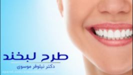 اصلاح طرح لبخند چیست ؟ دکتر نیلوفر موسوی متخصص زیبایی 