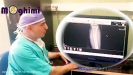 عمل جراحی ساق پا در شکستگی مجدد ساق پیوند استخوان