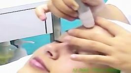 Crystal Microdermabrasion Demo.mp4