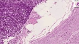 Shotgun Histology Appendix