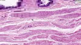 Shotgun Histology Bladder