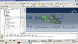 تحلیل مدل های بیومکانیکی Mimics توسط نرم افزار Abaqus