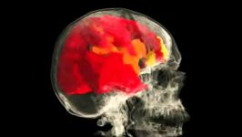 نگاهی به مغز یک خانم در هنگام ارگاسم در زیر دستگاه MRI