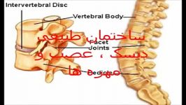 دیسک ، کمردرد دررفتگی یا لقی مهره کمر چیست؟