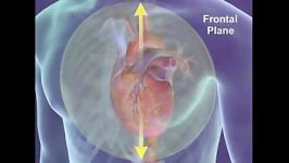 لیدهای EKG