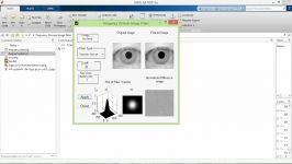 پروژه پردازش تصویر عنبیه چشم MATLAB