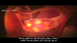 دکتر فریده عرب جهوانی درمان نازایی به شیوه IVF می گوید