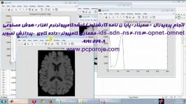 انجام پایان نامه سمینارپروپوزال کارشناسی ارشدکامپیوتر