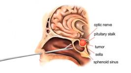 What is the Pituitary Gland