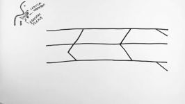 brachial plexus