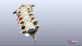 cervical spine