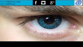 نمایش لنز فرشلوک Freshlook Turquoise