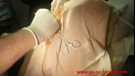 برداشت کیسه های مقعدی سگ  Removal anal sac