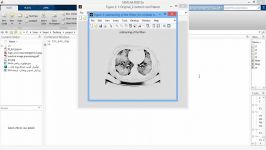 پروژه پردازش تصاویر پزشکی MATLAB