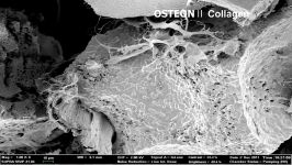 OSTEONⅡ Collagen