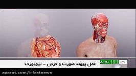 بی سابقه ترین پیوند صورت گردن در نیویورک انجام شد