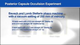 Capsular Safety Performance of the MST Dewey Radius Tip