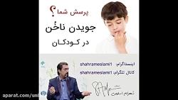 پرسش شما جویدن ناخن در کودکان چه کنیم؟