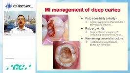 MI restoration of the deeply cavitated caries lesion 01