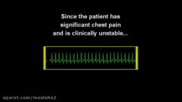 تغییرات ekg در cpr