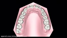 ارتودنسی نامرئی دکتر حاجی سید نصیر